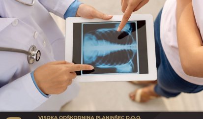 Odškodnina za zlomljeno rebro