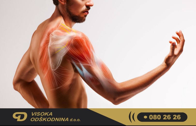 natrganost mi&scaron;ic