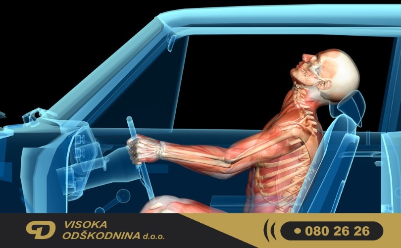 Po&scaron;kodbe vratne hrbtenice